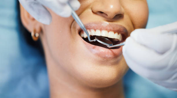 Best Broken Tooth Emergency  in Marion, IL